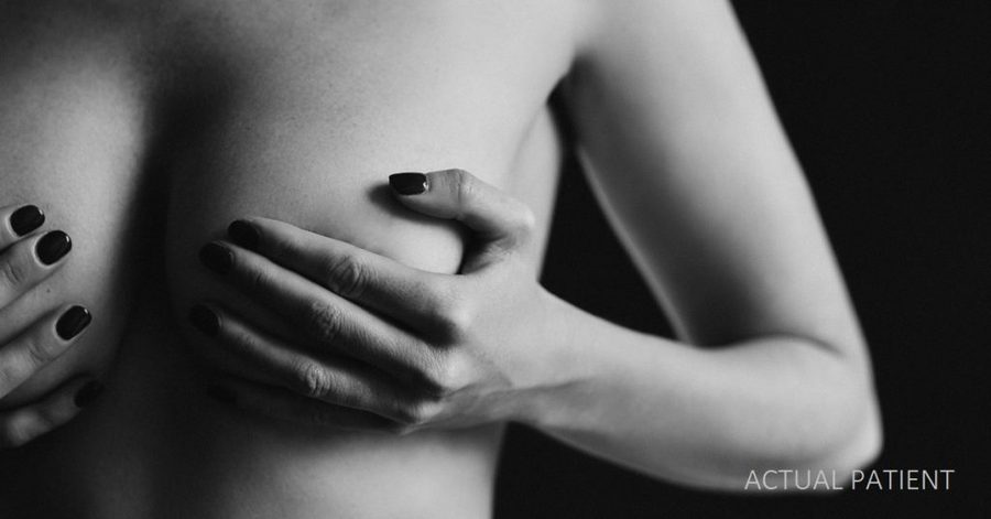Breast Augmentation Recovery: What's Normal (and What's Not) | Austin, TX