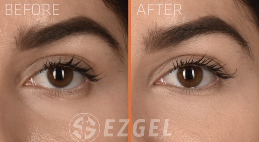 ezGEL results under the eye