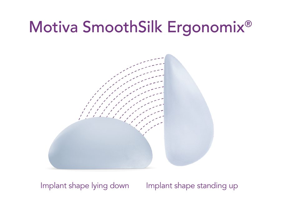 Motiva SmoothSilk Ergonomix implant