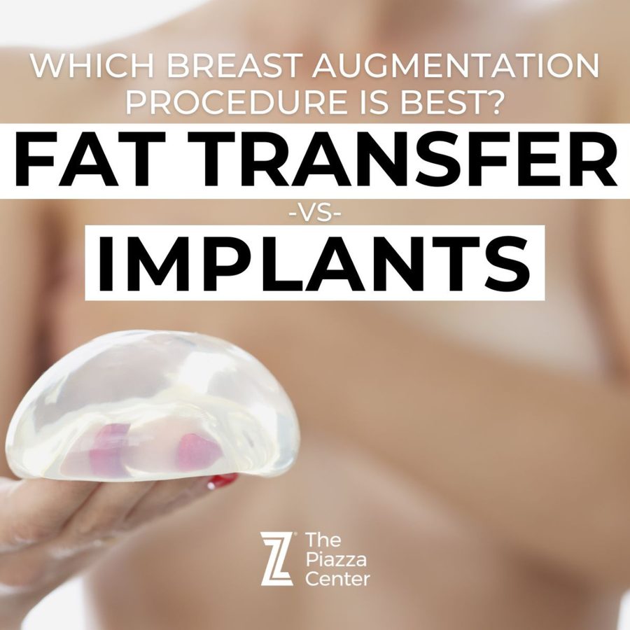 Fat Transfer vs Implants