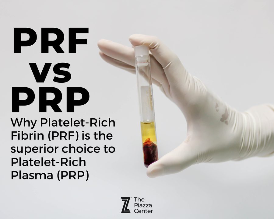 Vial of concentrated PRF prepared at The Piazza Center