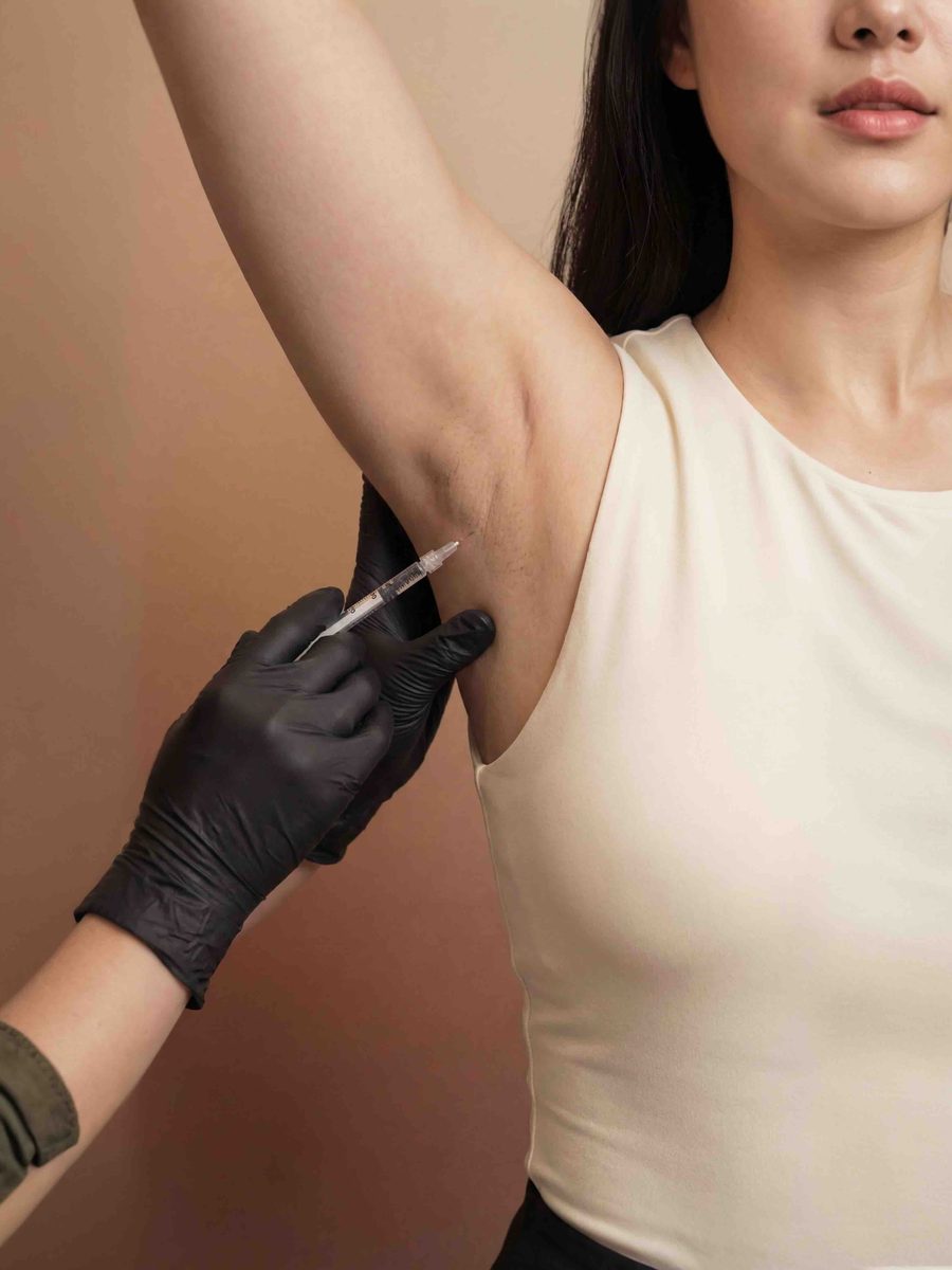Close-up of an underarm injection to treat excessive sweating